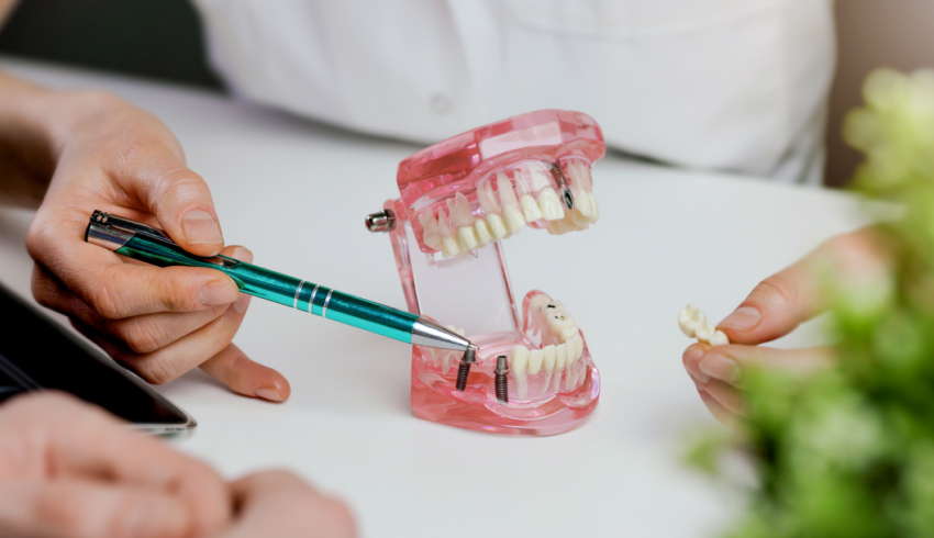 歯を長く健康に保つための選択肢として、インプラント治療は非常に重要な役割を果たします。