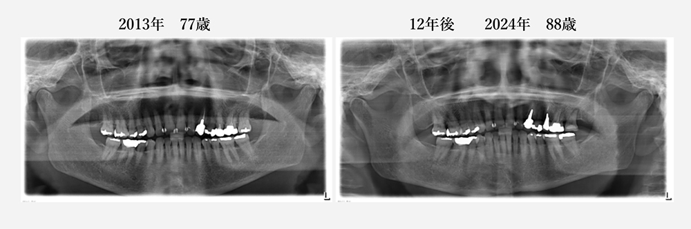 現在88歳の女性